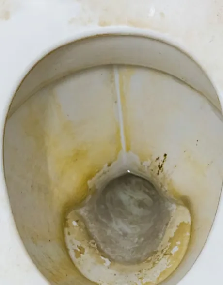 Hard water staining in a toilet bowl